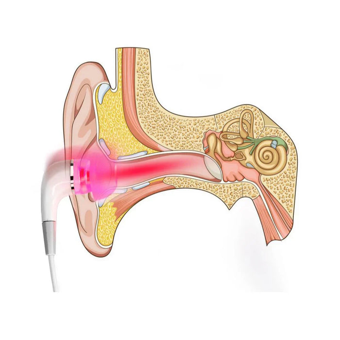 TinniPlug Tinnitus-verlichting Oordopjes | Comfort Oordopjes | Voor rust en ontspanning